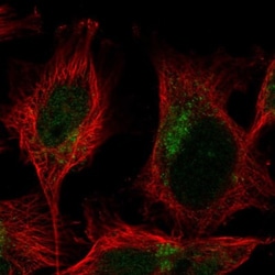 TMEM104 Antibody, Novus Biologicals 25 &mu;L, Unlabeled:Antibodies, Polyclonal